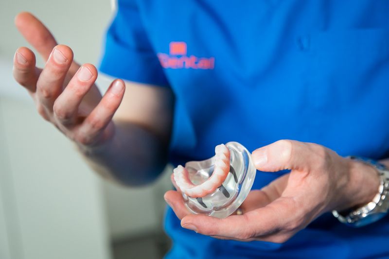 Teeth In A Day Cost Ireland